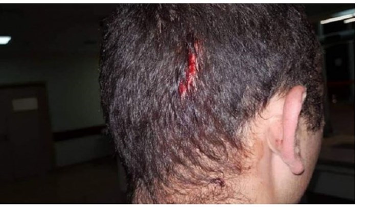 Έξι συλλήψεις για την επίθεση σε βάρος αστυνομικών