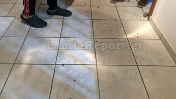 Βρήκε τον διαρρήκτη μέσα στο σπίτι του και τον μαχαίρωσε – ΦΩΤΟ