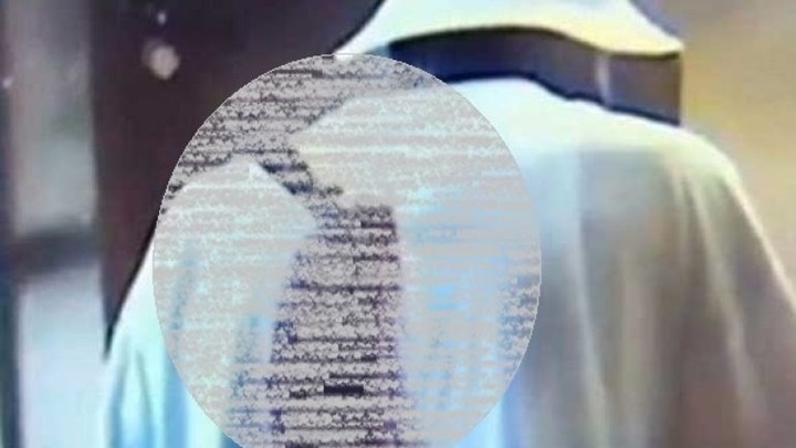 Βρήκε κουζινομάχαιρο καρφωμένο στην πλάτη του αλλά δεν… θυμάται τι έγινε