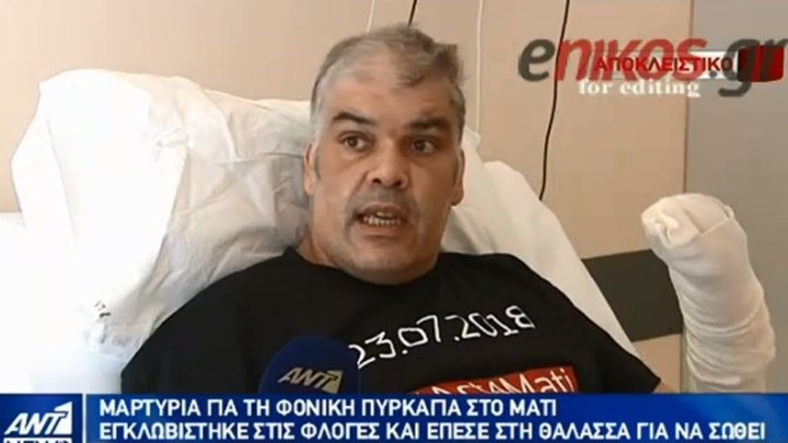 Τραυματίστηκε σοβαρά στη φονική πυρκαγιά στο Μάτι – Έμεινε για 78 ημέρες στην εντατική – Συγκλονίζει η μαρτυρία του – ΒΙΝΤΕΟ