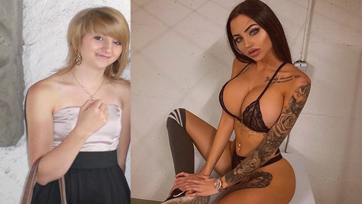 Έγινε μια… άλλη για να νικήσει το bullying – Έδωσε 40.000 ευρώ σε πλαστικές – ΦΩΤΟ