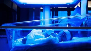 Συγκλονίζουν τα στοιχεία για τις γεννήσεις – Τουλάχιστον 15 εκατομμύρια μωρά γεννιούνται πρόωρα