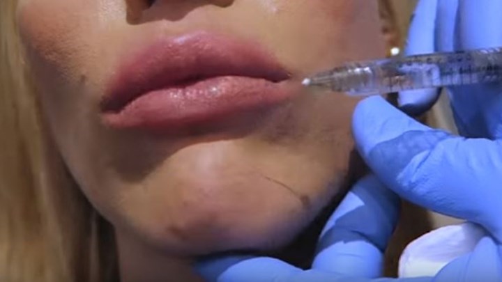 Γνωστή παρουσιάστρια φούσκωσε τα χείλη της on camera – ΒΙΝΤΕΟ