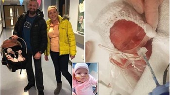 Κι όμως γίνονται θαύματα: Επέζησε μωράκι που γεννήθηκε 4 μηνών και ζύγιζε όσο μια μεγάλη σοκολάτα