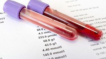 Νέο τεστ υπόσχεται διάγνωση του καρκίνου σε δέκα λεπτά