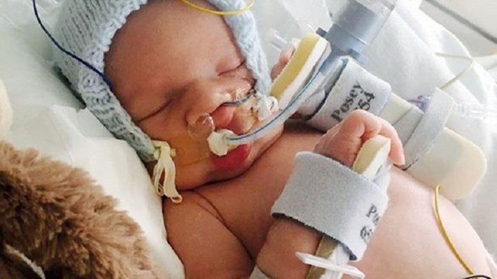 Θέληση για ζωή: Επιβίωσε βρέφος 15 μηνών που είχε κηρυχθεί εγκεφαλικά νεκρό – ΦΩΤΟ