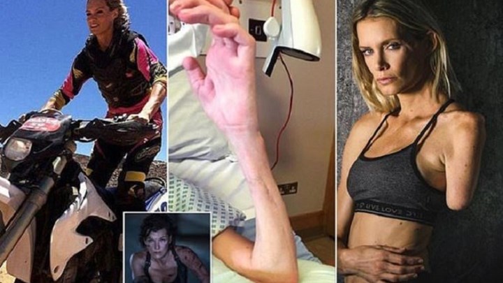 Αστρονομική αποζημίωση διεκδικεί η κασκαντέρ της Μίλα Γιόβοβιτς μετά από φρικιαστικό ατύχημα – ΦΩΤΟ