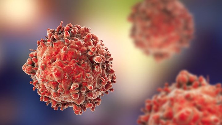 Θεραπεία λευχαιμίας με κολλύριο – Μεγάλη ανακάλυψη ελληνικής ιατρικής ομάδας