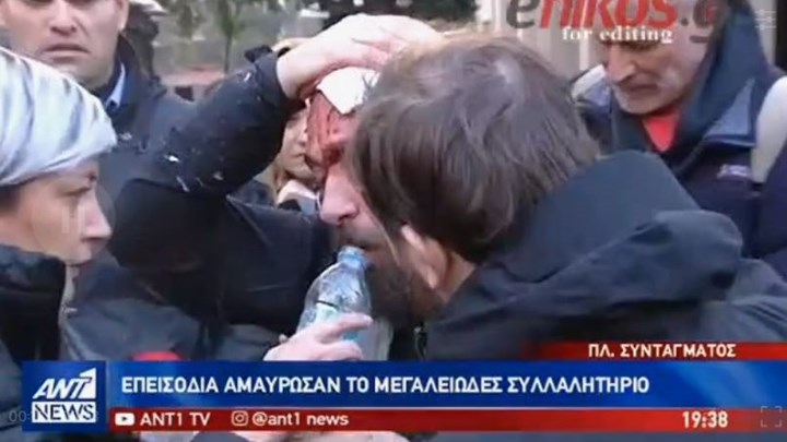 Τι είπε ο φωτορεπόρτερ για την επίθεση που δέχθηκε -ΒΙΝΤΕΟ
