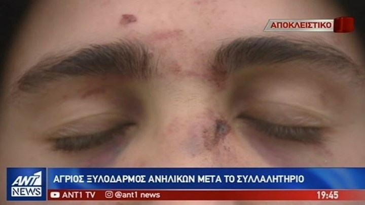 Άγριος ξυλοδαρμός ανηλίκων στο Θησείο μετά το συλλαλητήριο – ΒΙΝΤΕΟ