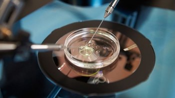 Ελληνίδα έμεινε έγκυος με τη μέθοδο των “τριών πατέρων”