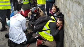 Σφοδρές συγκρούσεις στο Παρίσι – Χειροβομβίδα έσκασε στο χέρι διαδηλωτή – ΣΚΛΗΡΕΣ ΕΙΚΟΝΕΣ