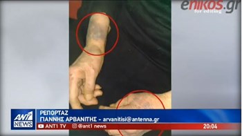 Συγκλονιστικές μαρτυρίες στον ΑΝΤ1 για τον θάνατο 88χρονης έπειτα από ληστεία -BINTEO