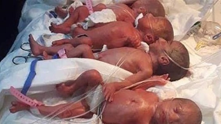 Γυναίκα από το Ιράκ γέννησε επτάδυμα – ΒΙΝΤΕΟ – ΦΩΤΟ