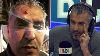 Ρατσιστική επίθεση δέχθηκε ραδιοφωνικός παραγωγός – ΦΩΤΟ