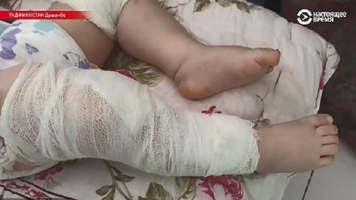 Τρυπούσε με βελόνες το κορμί του μωρού της για να φέρει πίσω τον άντρα της – ΦΩΤΟ