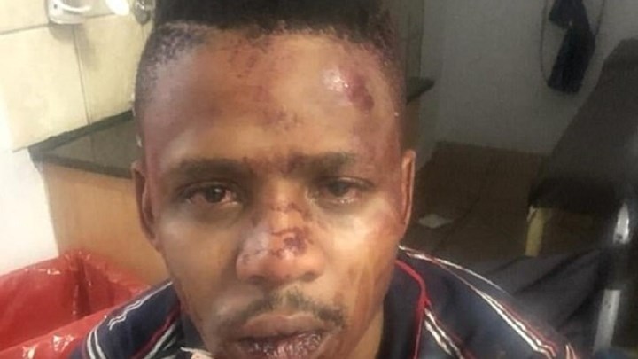 Σοκάρει ο άγριος ξυλοδαρμός παρουσιαστή στο Γιοχάνεσμπουργκ από ομάδα λευκών – ΦΩΤΟ