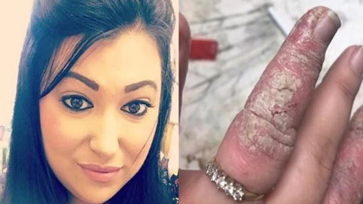 Πώς απαλλάχθηκε από το μαρτύριό της με μία απλή συμβουλή – ΦΩΤΟ