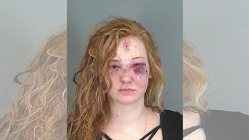 Επιτέθηκε στη σύντροφο του πρώην της αλλά εκείνη την έκανε μαύρη στο ξύλο – ΦΩΤΟ