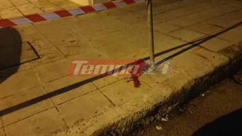 Νεκρή η γυναίκα που έπεσε από μπαλκόνι στην Πάτρα