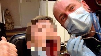 Στη φυλακή ο “δρ. Κακός” επειδή αντί για τατουάζ, έκοψε αυτιά και γλώσσα πελατών – ΦΩΤΟ