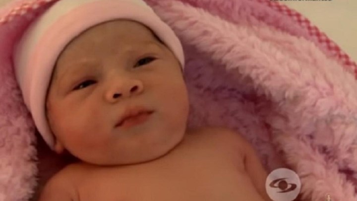 Σοκ στην Κολομβία: Νεογέννητο είχε στην κοιλιά του το δίδυμο αδελφάκι του – ΒΙΝΤΕΟ