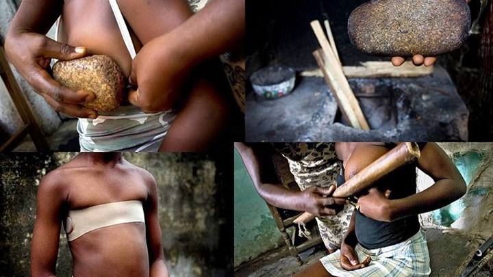 Εξομολόγηση που σοκάρει: Moυ σιδέρωσε το στήθος η μητέρα μου για να είμαι άσχημη – ΒΙΝΤΕΟ