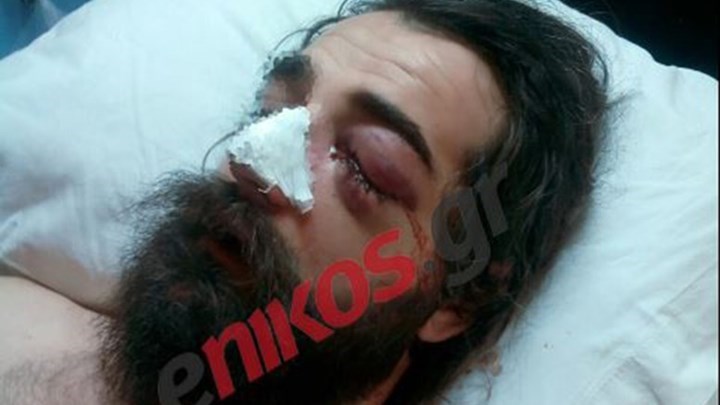 «Δεν πρόκειται να αφήσουμε την υπόθεση» δηλώνει στο enikos.gr ο δικηγόρος του 31χρονου που έχασε το μάτι του στα επεισόδια του ΟΑΚΑ
