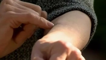 Σπάνια γενετική μετάλλαξη: Αυτή η γυναίκα δεν νιώθει πόνο – ΒΙΝΤΕΟ