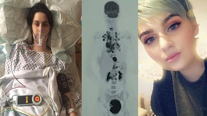 Επέστρεψε τις δωρεές για την κηδεία της αφού διέψευσε τους γιατρούς και έζησε – ΦΩΤΟ