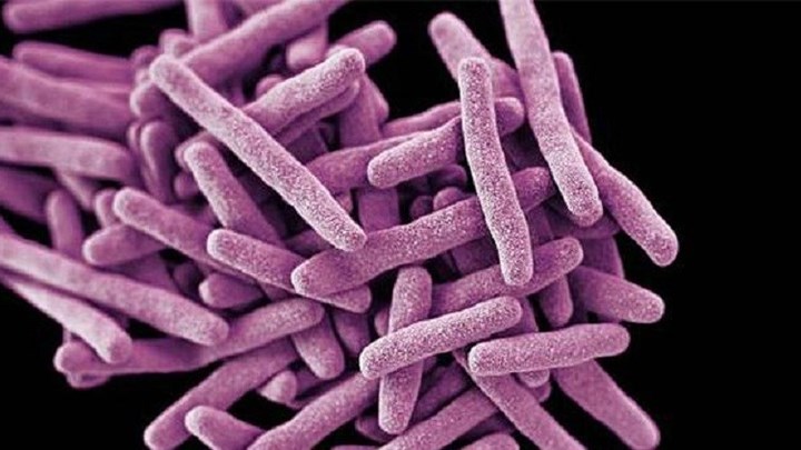 Μυστηριώδες μικρόβιο εξαπλώνεται στον κόσμο – Τι αποκαλύπτουν οι New York Times