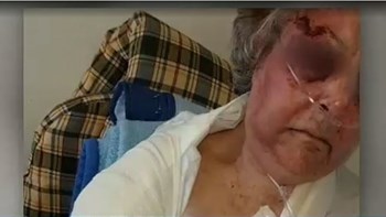 Η συγκλονιστική μαρτυρία της 85χρονης που έπεσε θύμα ληστείας: Ήθελαν να με πνίξουν -ΒΙΝΤΕΟ