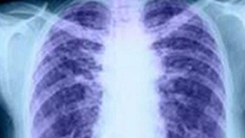 Επιστήμονες δημιούργησαν διαφανή ανθρώπινα όργανα