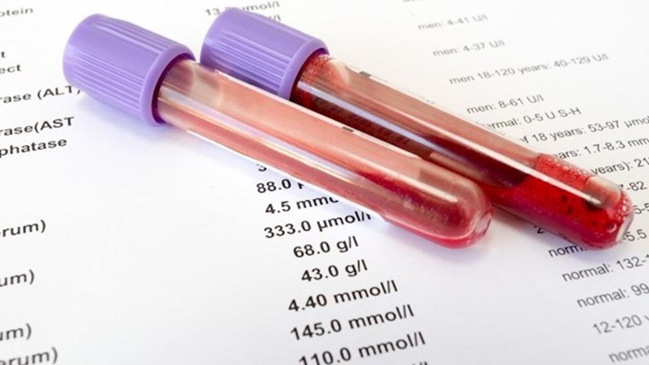 Άνδρας πήγε για εξετάσεις αίματος και βγήκε… έγκυος