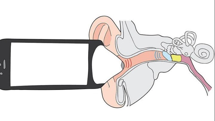 “Έξυπνη” εφαρμογή κινητού ανιχνεύει την ωτίτιδα στα παιδιά