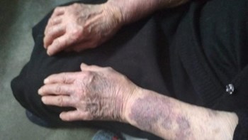 Απολογούνται οι κατηγορούμενοι για το θάνατο της ηλικιωμένης στη Σητεία