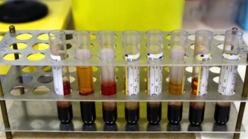 Τριήμερο ”λουκέτο” στα διαγνωστικά κέντρα – Χωρίς εξετάσεις οι ασφαλισμένοι