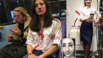 Σοκ στο Λονδίνο: Ξυλοκόπησαν αεροσυνοδό και τη σύντροφό της επειδή δεν δέχθηκαν να φιληθούν – ΦΩΤΟ