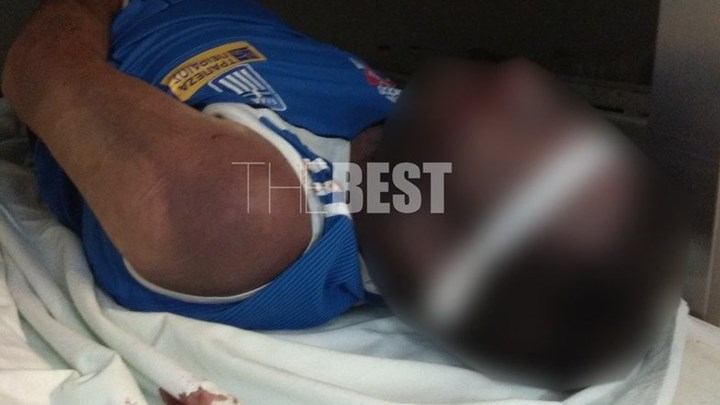 Φωτογραφίες σοκ από τον νεκρό κρατούμενο στις φυλακές Αγίου Στεφάνου – ΣΚΛΗΡΕΣ ΕΙΚΟΝΕΣ