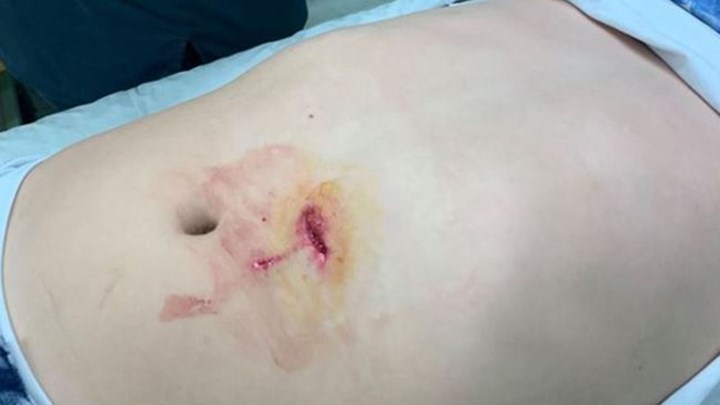 Εντεκάχρονος καρφώθηκε στα κάγκελα εκκλησίας στα Βριλήσσια – Τι καταγγέλλει ο πατέρας του – ΦΩΤΟ