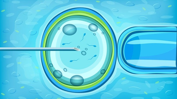 Γιατρός χρησιμοποιούσε σε εξωσωματικές το δικό του σπέρμα