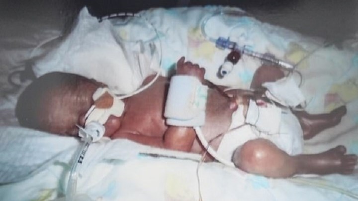 Μωρό αψήφησε τον θάνατο – Γεννήθηκε στις 24 εβδομάδες και ζύγιζε μόλις μισό κιλό – ΦΩΤΟ
