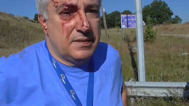 Οι πρώτες δηλώσεις του τραυματία πιλότου του μονοκινητήριου αεροπλάνου – ΒΙΝΤΕΟ