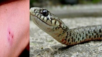 Τον δάγκωσε φίδι ενώ απολάμβανε το ποτό του – Δεν φαντάζεστε την αντίδρασή του