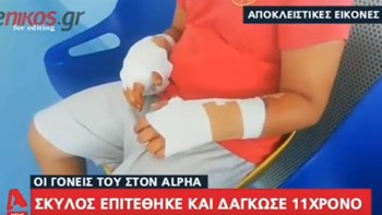 Σκύλος επιτέθηκε και δάγκωσε 11χρονο στην Εύβοια – Πώς περιγράφουν οι γονείς το περιστατικό – ΒΙΝΤΕΟ