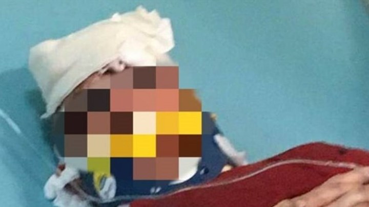 Σε κρίσιμη κατάσταση φύλακας μεταφορικής εταιρείας που δέχτηκε επίθεση από διαρρήκτες – ΦΩΤΟ