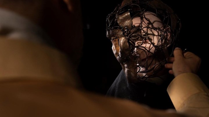 Οι πρώτες φωτογραφίες από τον «Άνθρωπο Ελέφαντα» μόνο στο enikos.gr