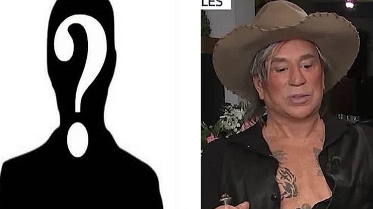 Αγνώριστος διάσημος ηθοποιός μετά τις πλαστικές – ΦΩΤΟ – ΒΙΝΤΕΟ