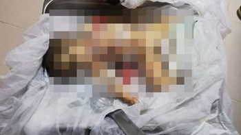 Σοκαριστικές εικόνες με το νεκρό μωρό από την επίθεση με όλμους