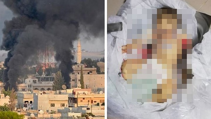 Μεγαλώνει συνεχώς ο κύκλος αίματος στη Συρία: Στους 174 οι νεκροί – Επελαύνει η Τουρκία – Αντίποινα από τους Κούρδους – Εικόνες φρίκης – ΦΩΤΟ – ΒΙΝΤΕΟ